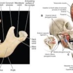 Mandibular Condyle